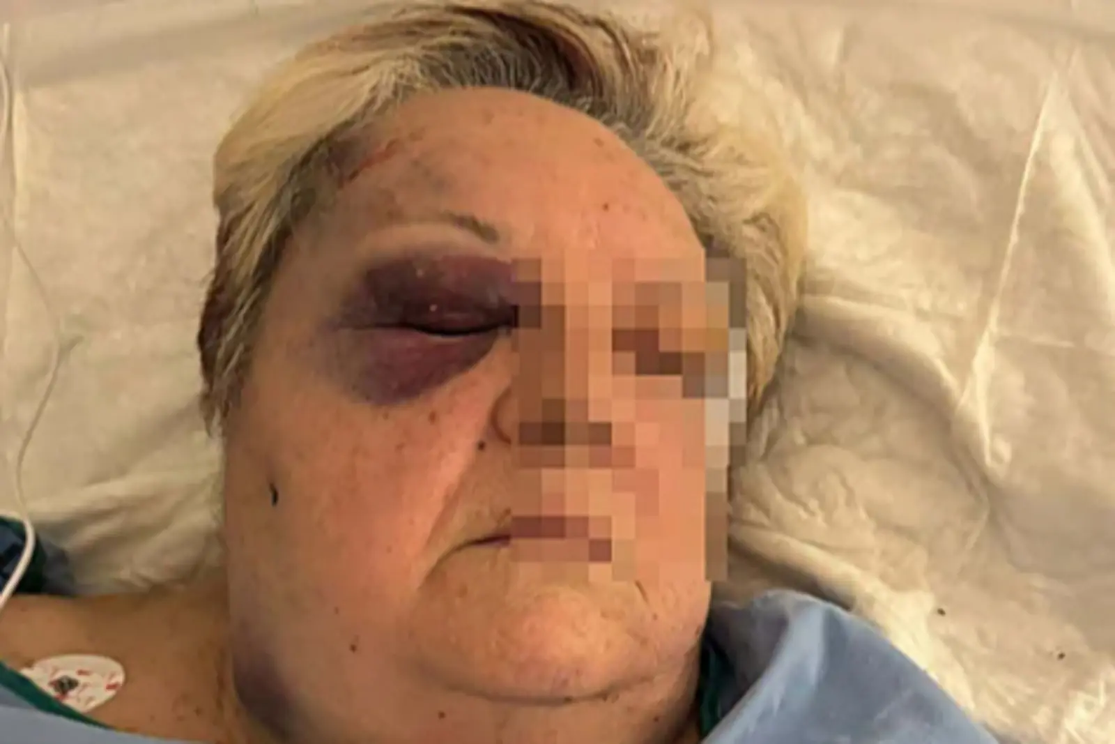 Brutal agresión a una mujer de 71 años a plena luz del día durante un intento de robo