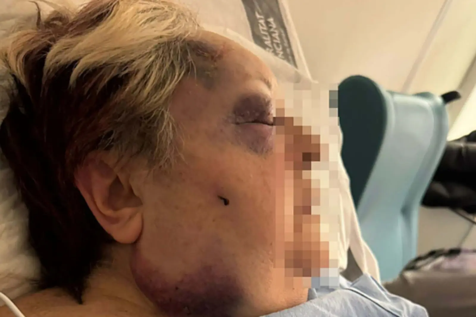 Una vecina de Campanar, Valencia, de 71 años, sufrió una agresión salvaje