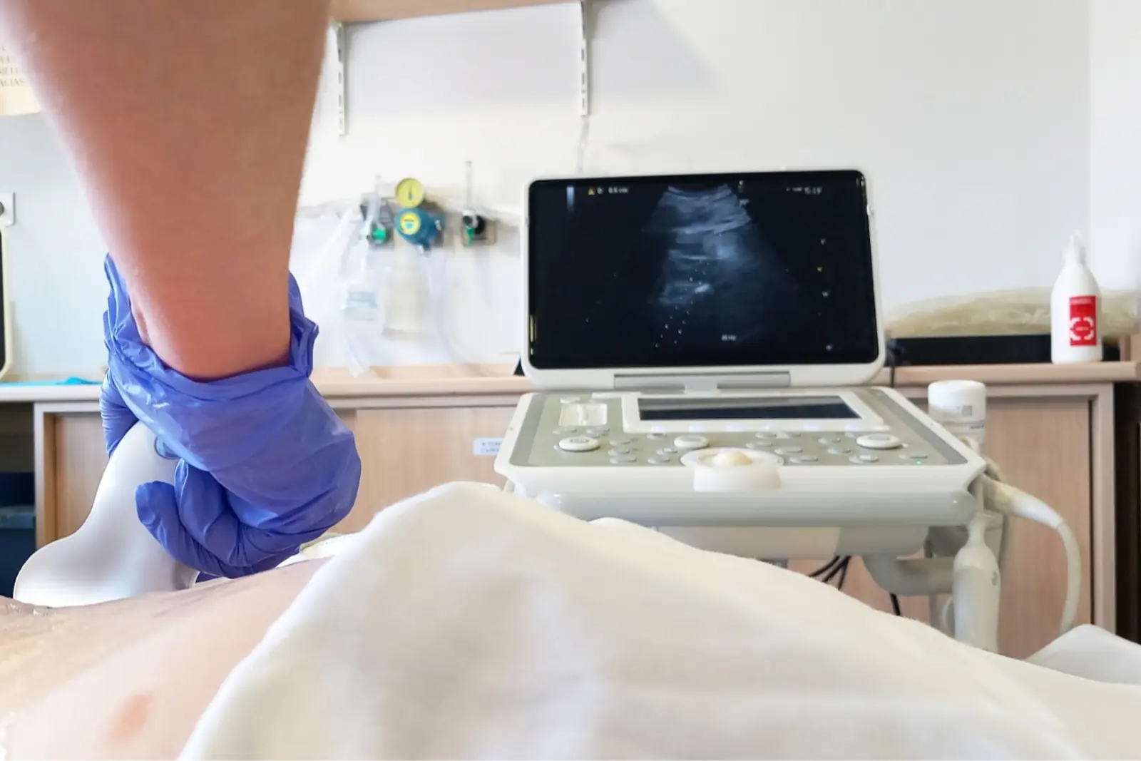 La Xunta adjudica por casi 520.000 euros el suministro de ecógrafos para hospitales comarcales del Sergas