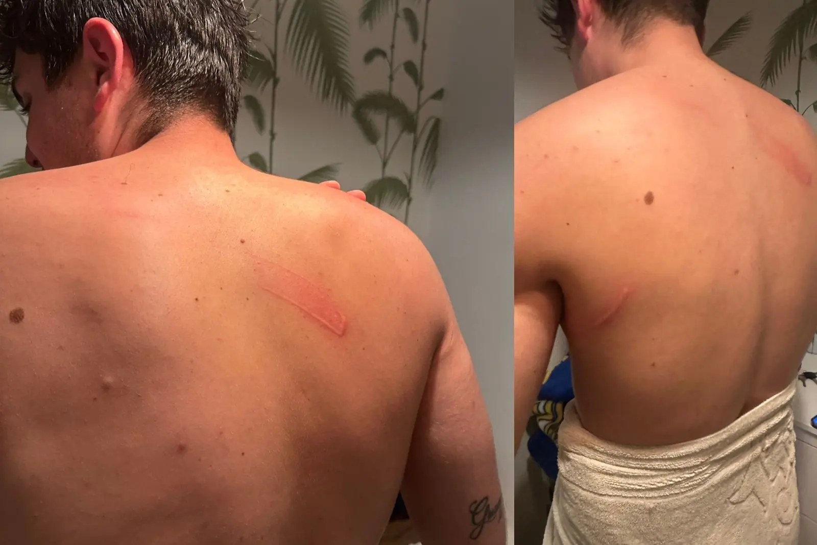 Heridas en la espalda de Vito Quiles