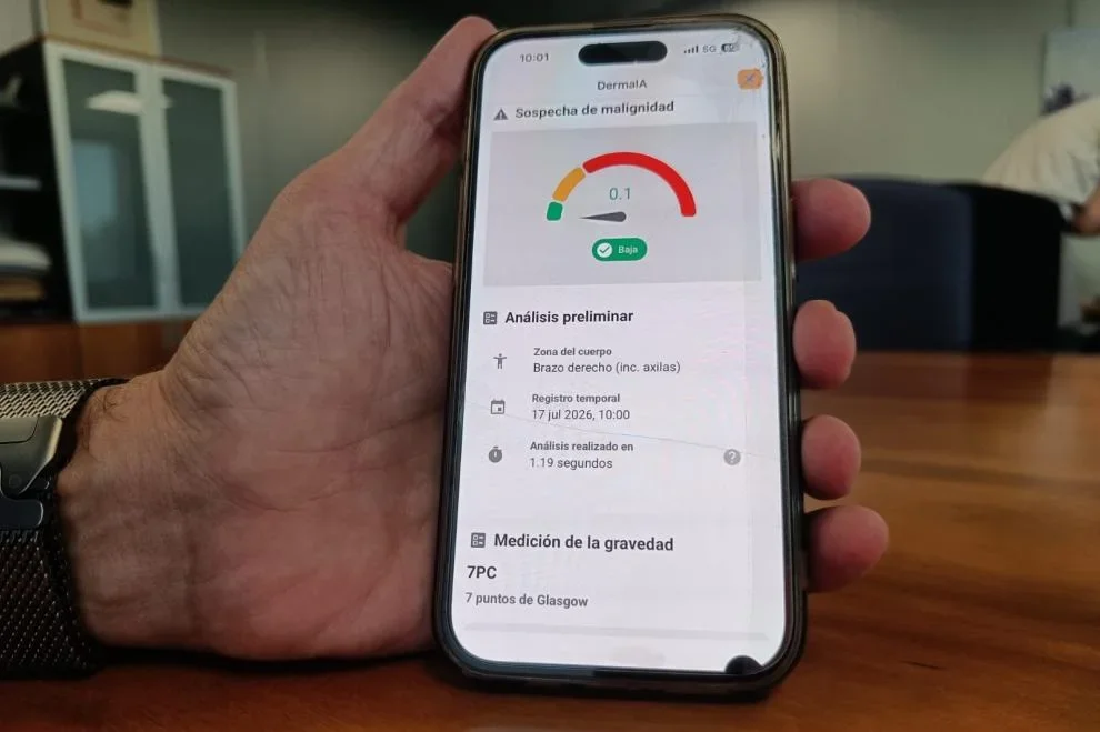 Aragón impulsa la inteligencia artificial para mejorar el diagnóstico de enfermedades de la piel