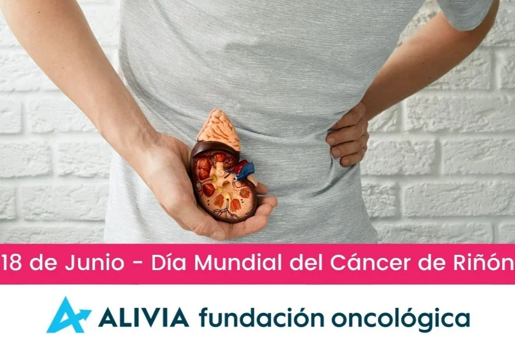 Solo 2 de 8 tratamientos recomendados para cáncer de riñón se financian en España