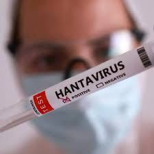 Fallece un Guardia Civil de un infarto en el traslado de pasajeros por Hantavirus